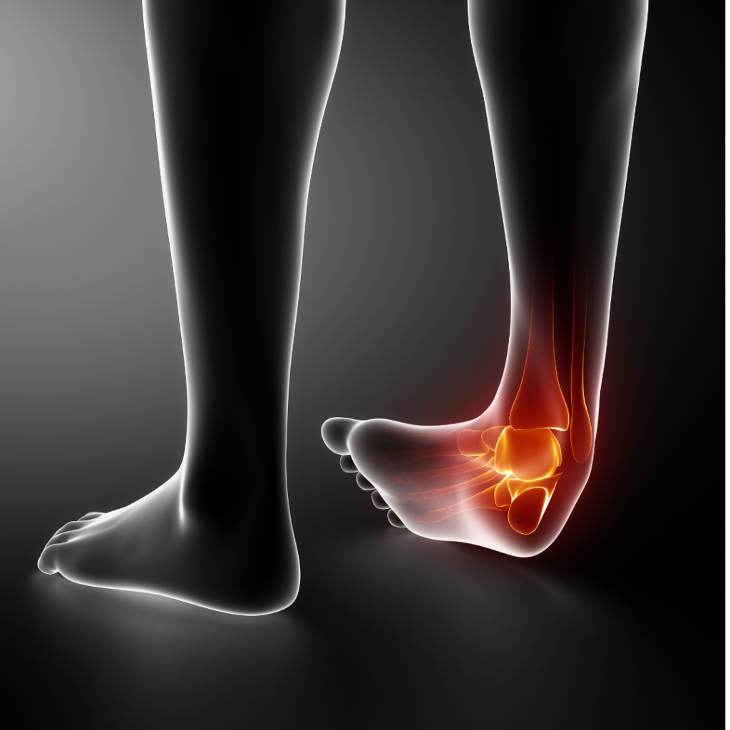 Les Huiles essentielles pour soulager une entorse